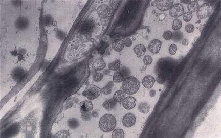 Phytoplasme du stolbur